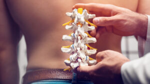 Spine surgeon holding model of vertebrae up to patient's back